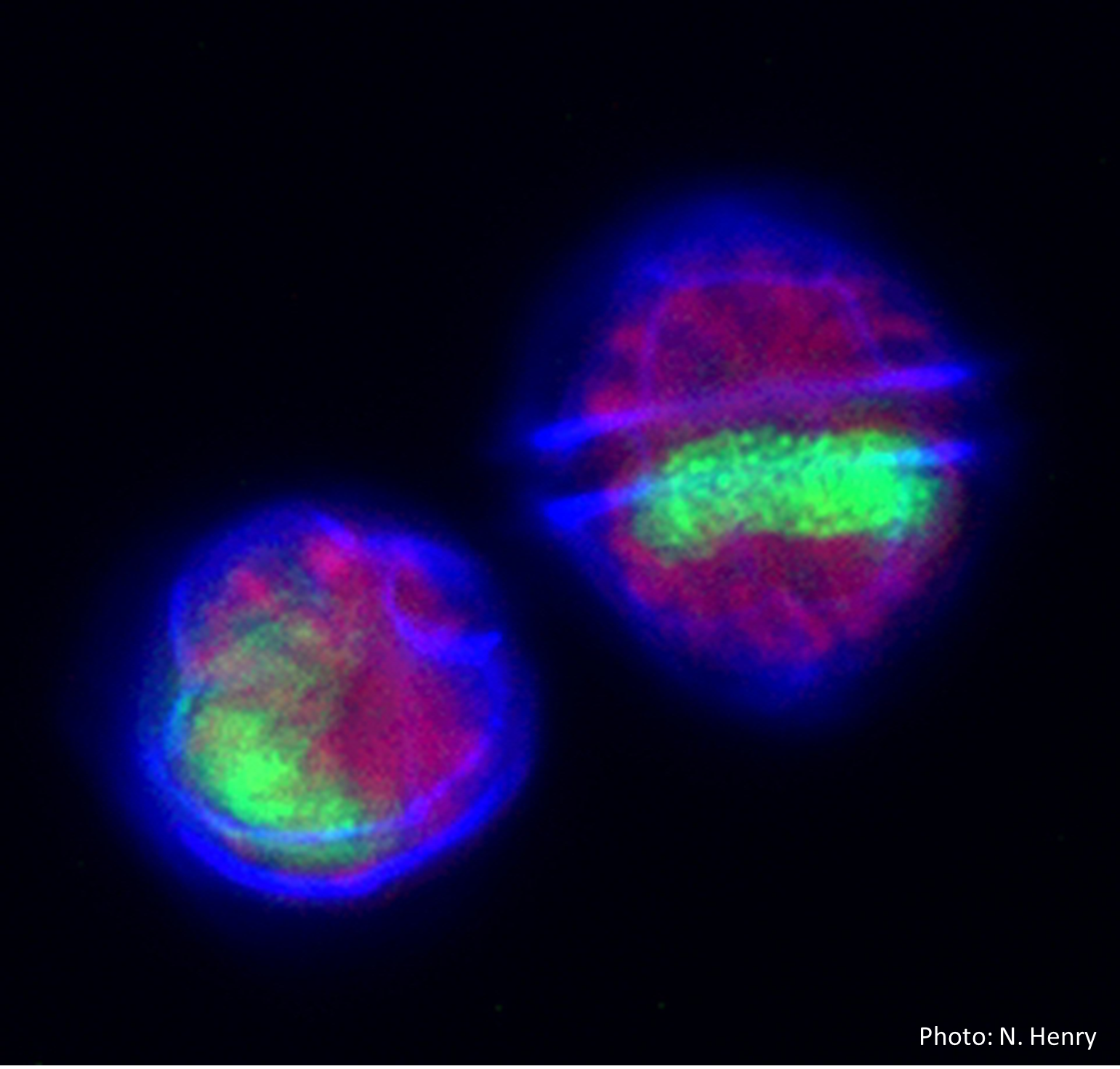Alexandrium minutum - microscope à epifluorescence